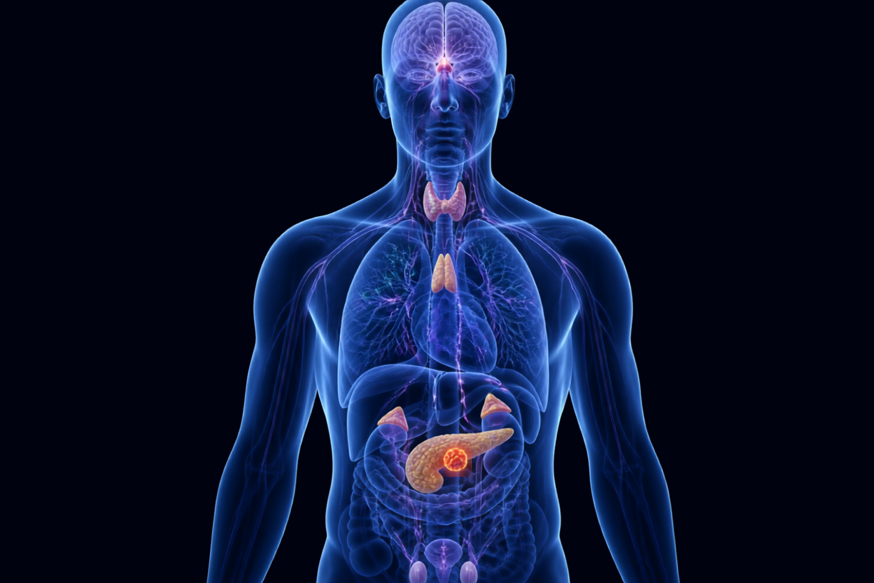 Endocrine and Neuroendocrine Cancers