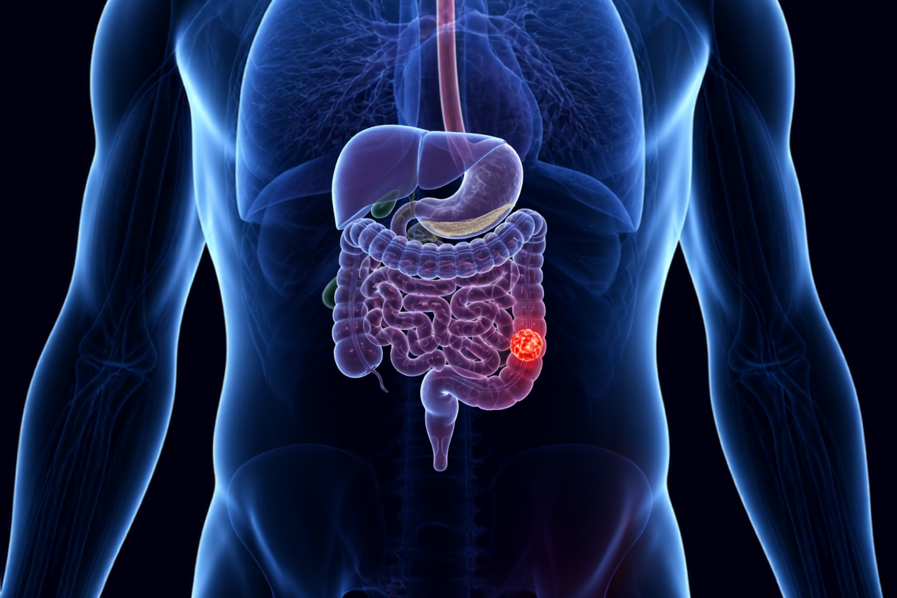Gastrointestinal Cancers